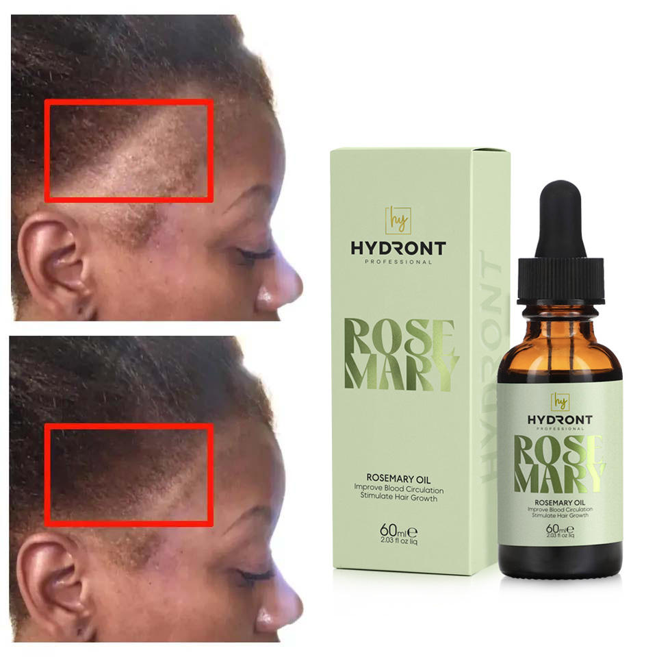 Nourishing Rosemary Hair Growth Oil